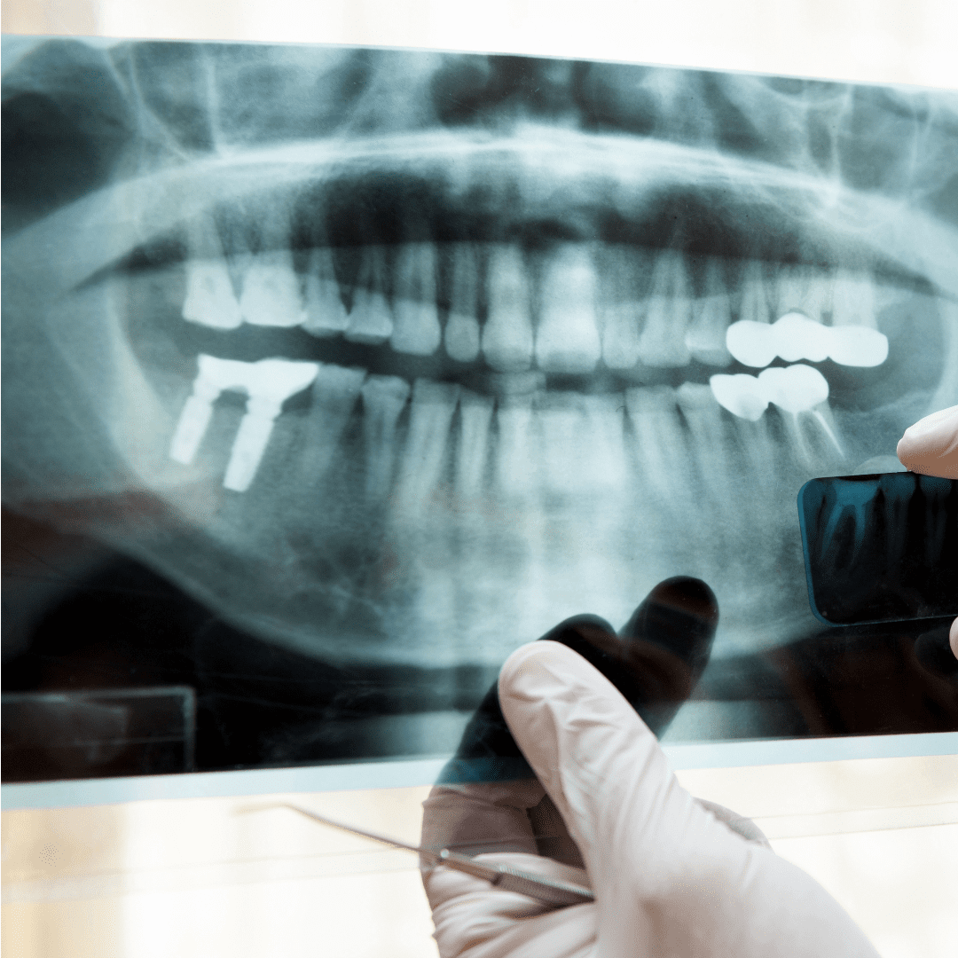 Auxiliares de Diagnóstico y Apoyo Clínico en Odontología: Pilares de la Precisión y el Cuidado del Paciente